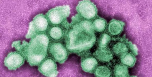 H1N1-Virus1