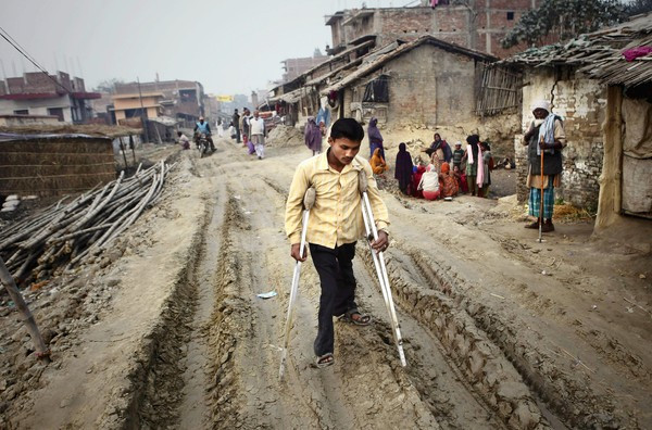 Polio in India